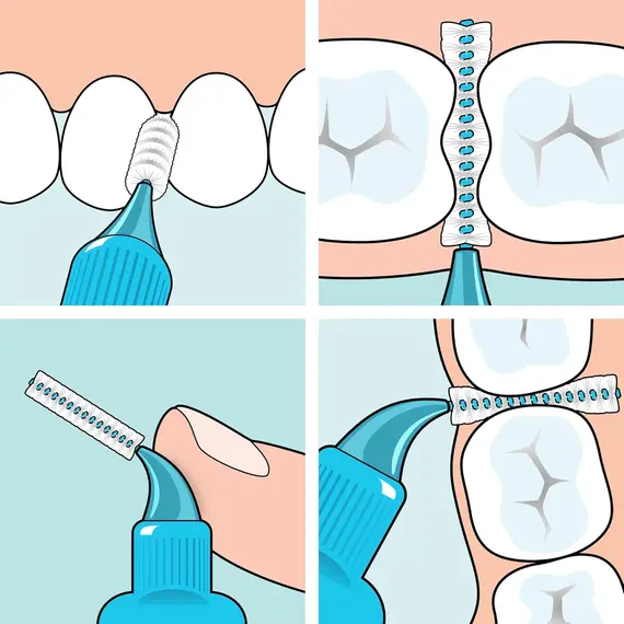 Buy TePe Interdental Brush, Original, Green, 0.8mm/ISO 5, 8pcs Plaque removal, Effective clean between the teeth, Brush for small gaps, 5 image